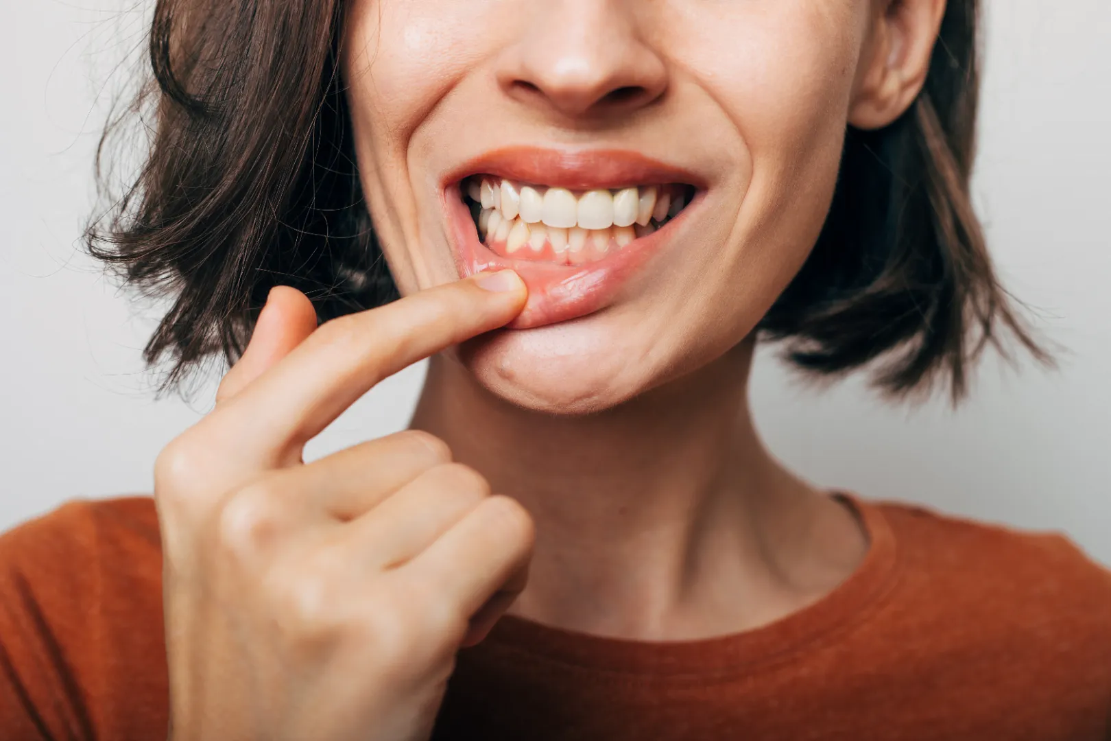 Close-up showing signs of periodontal disease